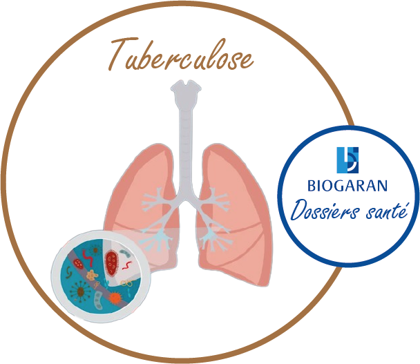 La tuberculose: tout comprendre - Biogaran Monde